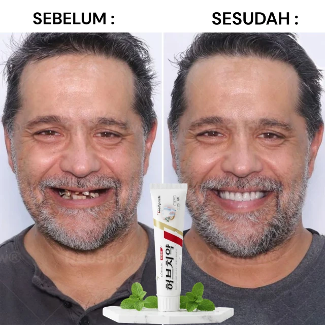 Menumbuhkan Gigi
